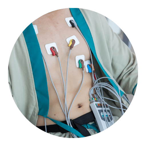 Holter Test in Mohali