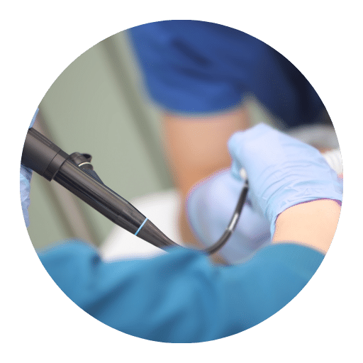 Bronchoscopy in Mohali
