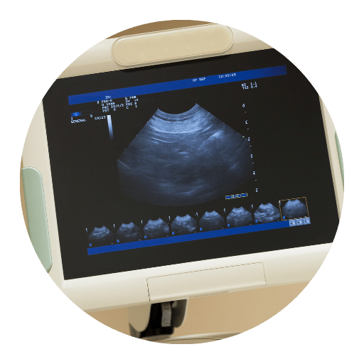 Trans Esophageal Echo in Mohali