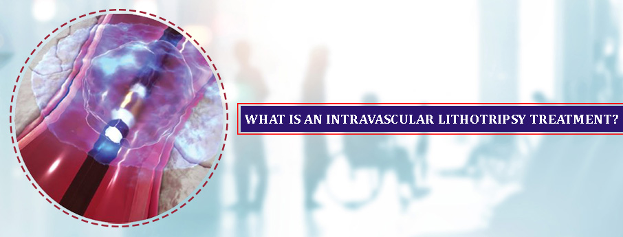 What-is-an-Intravascular-Lithotripsy-Treatment
