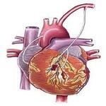 Adult Cardiac Surgery and CABG in mohali