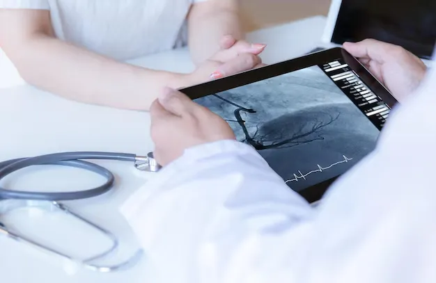 coronary-angiography
