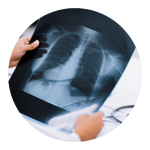 Stress Chest X-Ray in Mohali