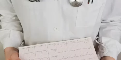 Diagnosis of Atrial Fibrillation